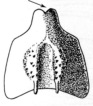 Tmethis pulchripennis